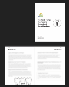 tm ebook implant sample